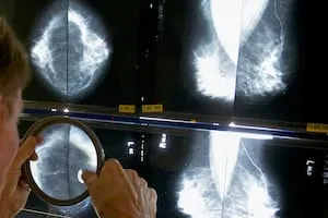 Uxbridge High School to undergo testing after multiple breast cancer diagnoses among teachers